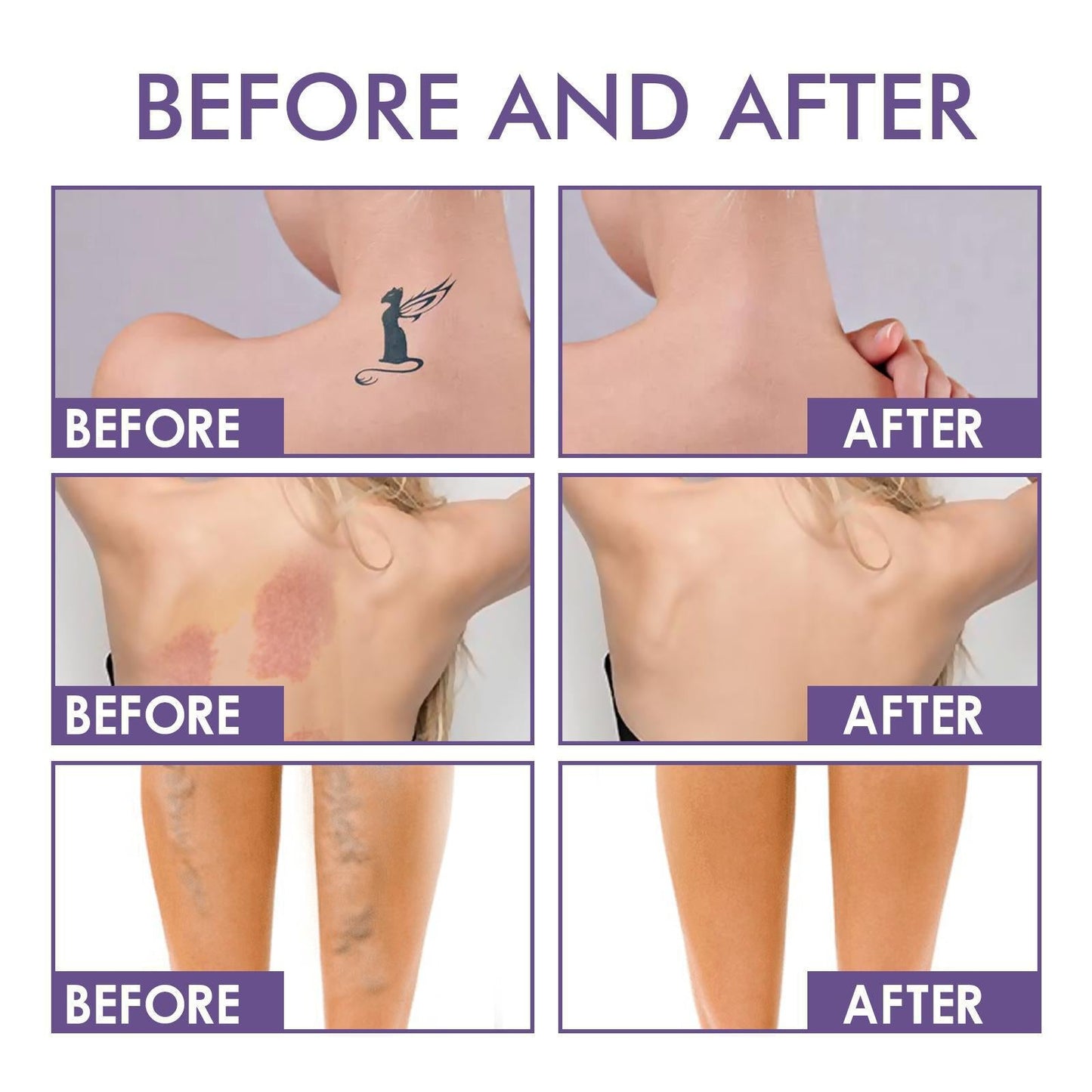 💜Último día: ¡compra 1 y llévate 1 gratis!💜✨Body Perfector: maquillaje corporal resistente al agua, ligero e impecable.-ES