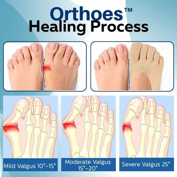 Ορθοπεδικές κάλτσες Orthoes™-GR