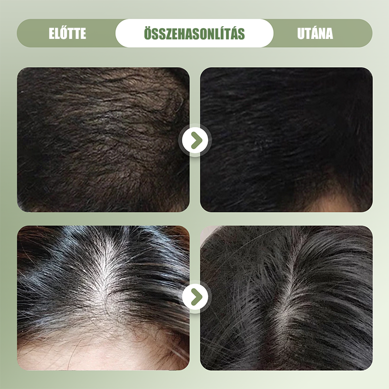 🌿 Φυσικό Σαμπουάν σε Μπάρα για Ενδυνάμωση Μαλλιών 🌱🥰-GR