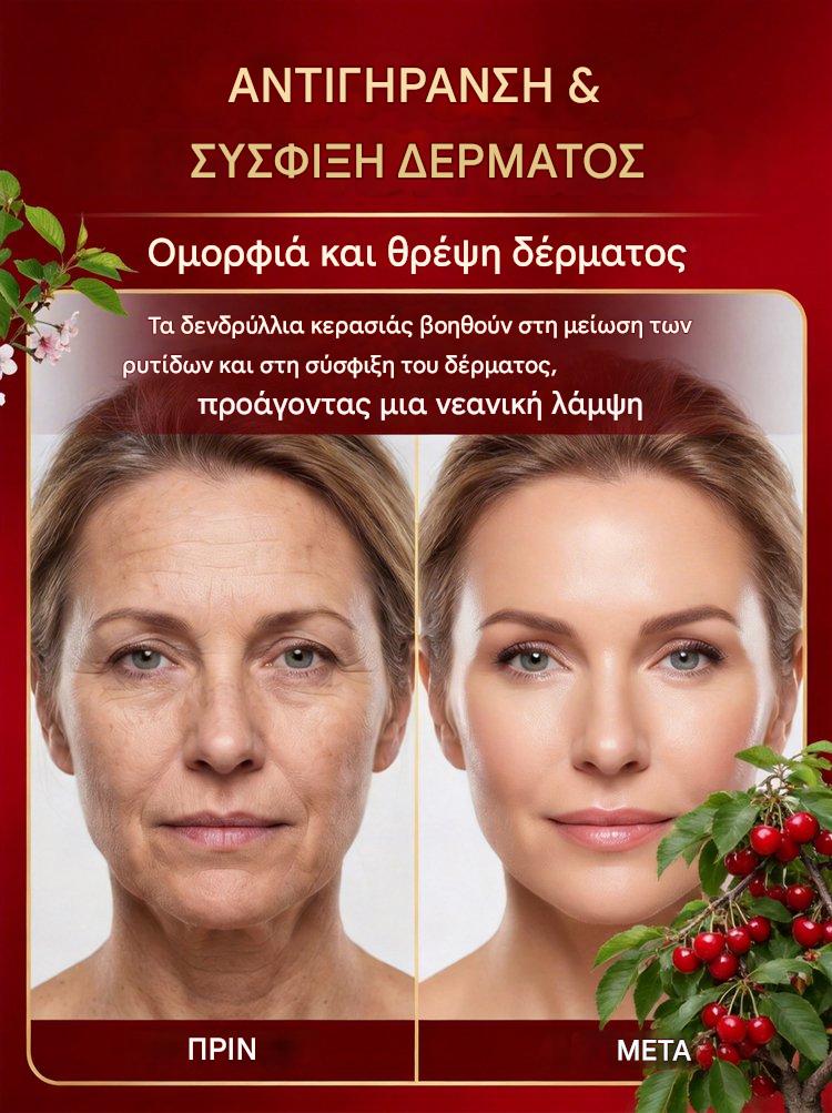 【Φρεσκοκομμένα】Νάνοι δενδρύλλια κερασιάς-GR