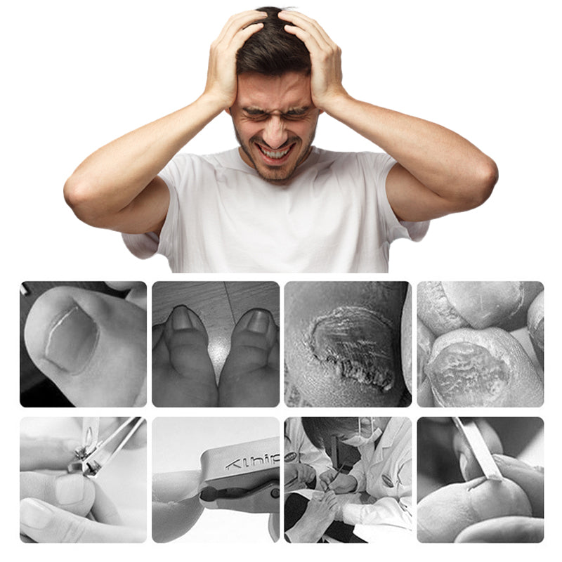 Juego profesional de cortaúñas para uñas encarnadas, 7 piezas-ES