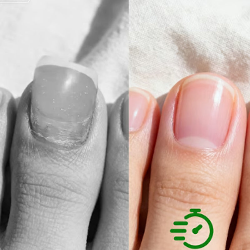 Una solución suave y eficaz para la reparación de uñas naturales-ES