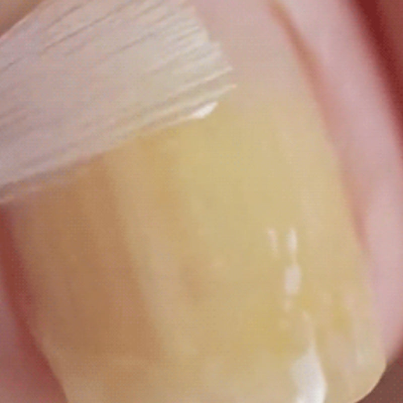 Una solución suave y eficaz para la reparación de uñas naturales-ES